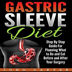 Gastric Sleeve Diet: Step by Step Guide for Planning What to Do and Eat Before and After Your Surgery